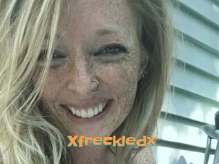 Xfreckledx